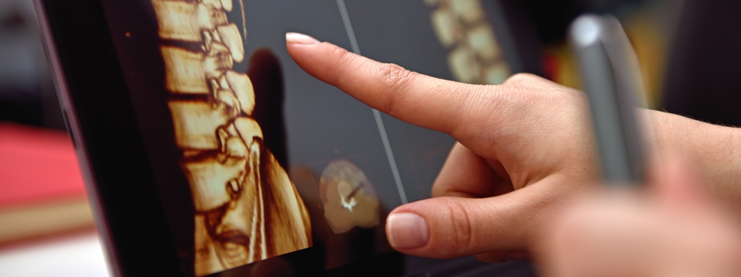 Hand pointing on screen with X-rays of the spine. close up